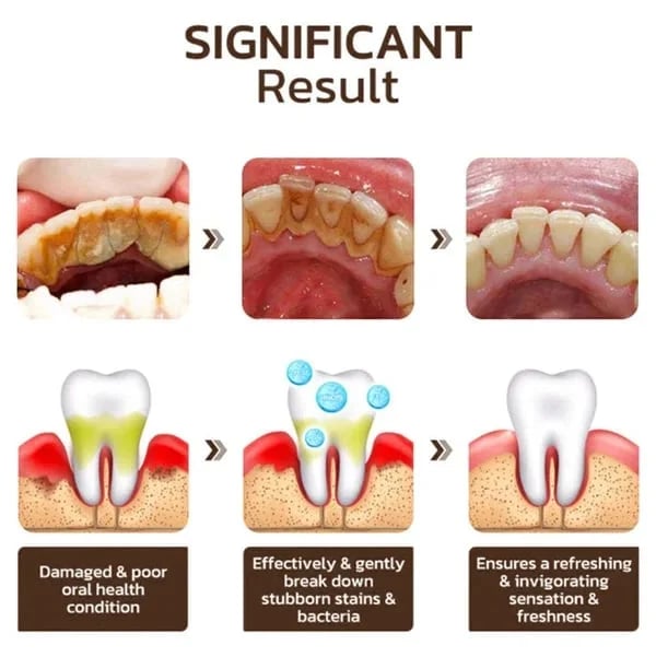 🔥$19.99 ONLY TODAY!!🎁Clearance Sale - Non Fluoride, Hydroxyapatite, Whitening Toothpaste