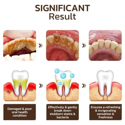 🔥$19.99 ONLY TODAY!!🎁Clearance Sale - Non Fluoride, Hydroxyapatite, Whitening Toothpaste